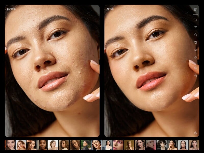Side-by-side comparison of a woman's face labeled "Before" and "After." The "Before" image shows her skin with acne and blemishes, while the "After" image shows her skin smooth and clear. A row of smaller portraits is displayed at the bottom of the frame.